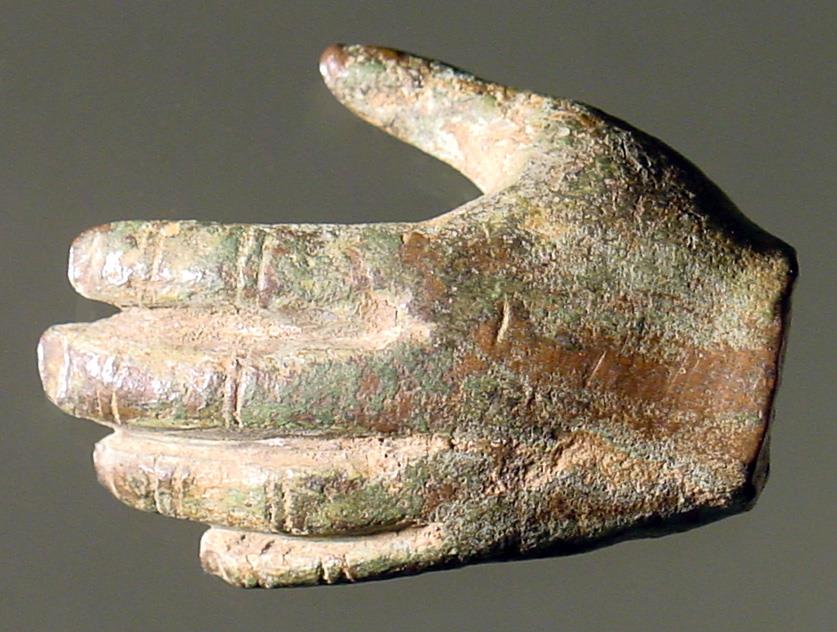 Abgebrochene linke Hand