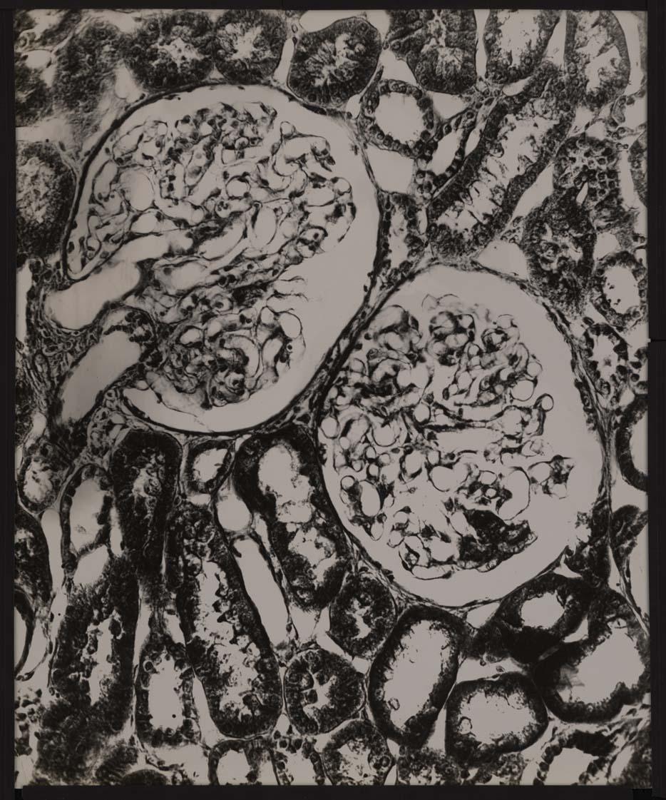 Niere. Glomeruli. Gefässpol.