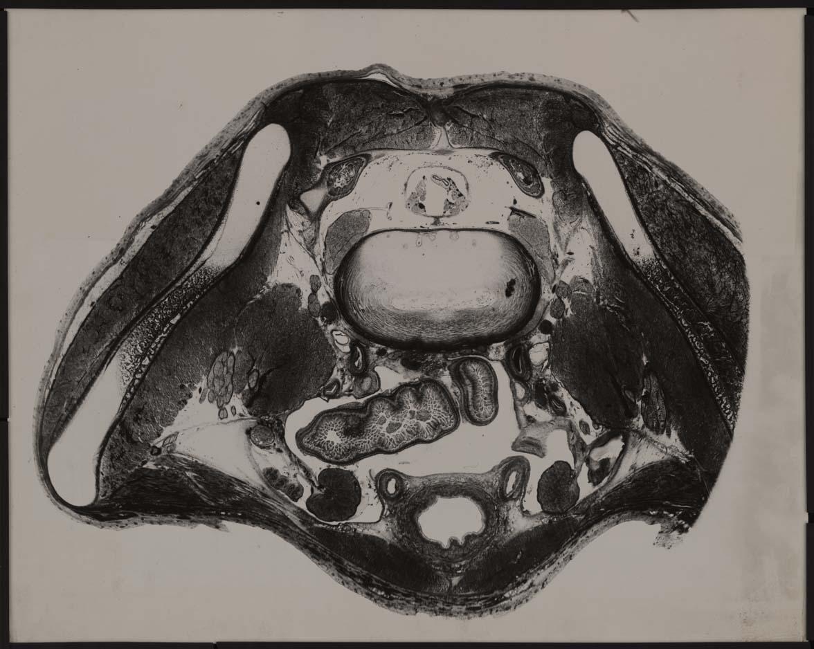 Beckenquerschnitt. Foet Mens 4. Descensus Testiculorum.