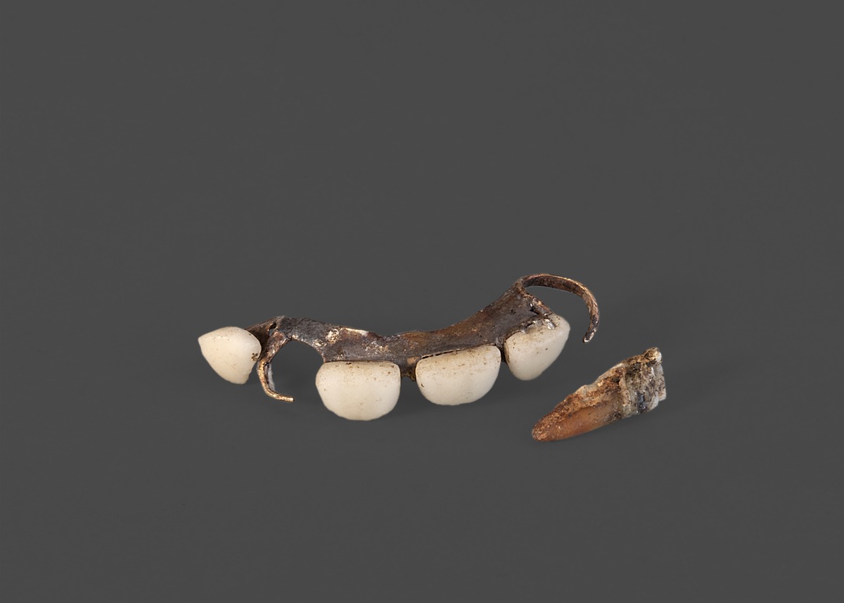 Zahnprothese