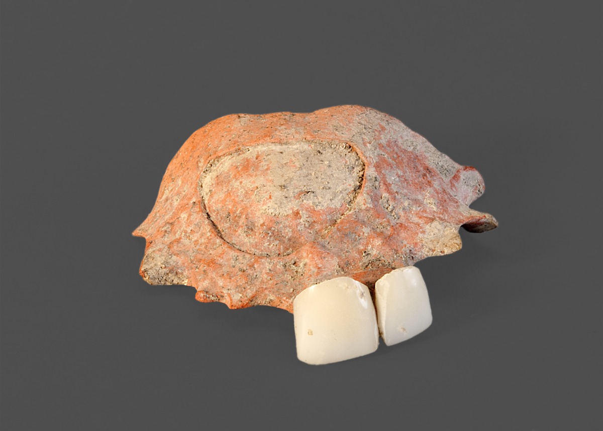 Zahnprothese
