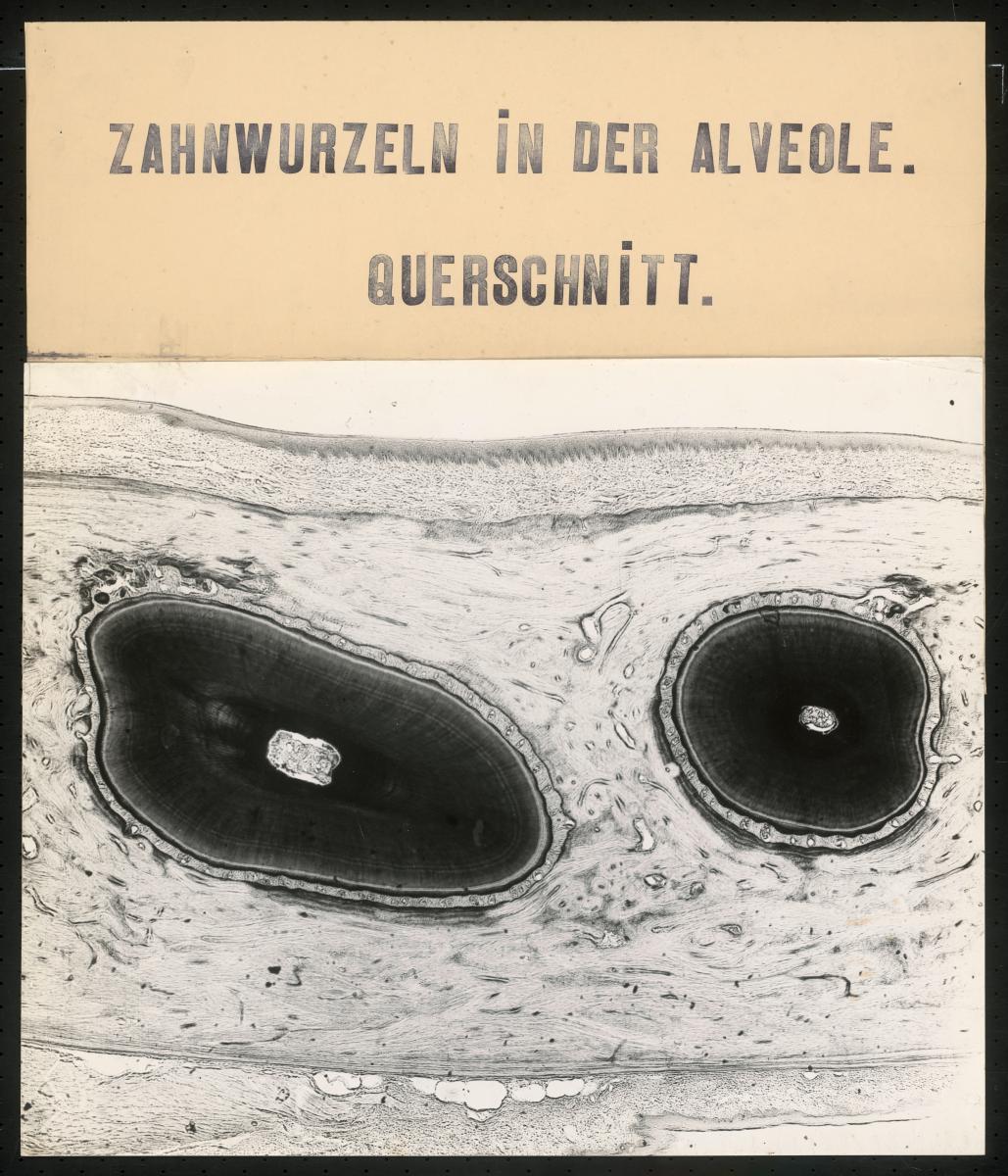 Zahnwurzeln in der Alveole. Querschnitt.