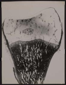Tibia. Knorpel-Knochen-Grenze. Epiphysenkern.