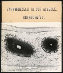 Zahnwurzeln in der Alveole. Querschnitt.